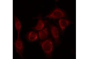 ABIN6266732 staining HepG2 by IF/ICC. (PTTG1 antibody  (Internal Region))