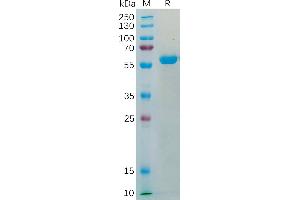 Human TM4SF1 Protein, hFc Tag on SDS-PAGE under reducing condition.