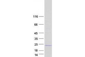 Chromosome 1 Open Reading Frame 194 (C1ORF194) protein (Myc-DYKDDDDK Tag)
