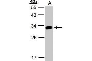 WB Image Sample(30 ug whole cell lysate) A:Raji , 12% SDS PAGE antibody diluted at 1:1000 (IFI30 antibody  (Center))