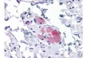 Immunohistochemistry (IHC) image for anti-Stromal Interaction Molecule 1 (STIM1) (AA 24-686) antibody (ABIN614666) (STIM1 antibody  (AA 24-686))
