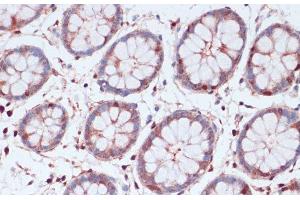 Immunohistochemistry of paraffin-embedded Human colon using S100A5 Polyclonal Antibody at dilution of 1:100 (40x lens). (S100A5 antibody)
