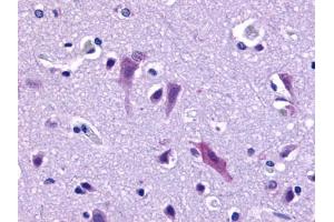 Anti-QRFPR / GPR103 antibody IHC of human brain, neurons and glia. (QRFPR antibody  (Cytoplasmic Domain))