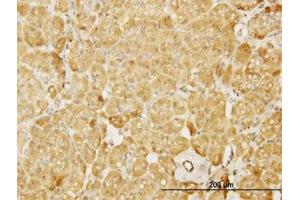 Image no. 2 for anti-Neural Wiskott-Aldrich syndrome protein (WASL) (AA 97-185) antibody (ABIN598590) (Neural Wiskott-Aldrich syndrome protein (WASL) (AA 97-185) antibody)