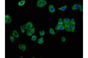 Immunofluorescence staining of HepG2 cells with ABIN7156777 at 1:133, counter-stained with DAPI. (IL12RB2 antibody  (AA 366-470))