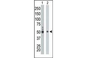 The anti-KIST Pab (ABIN6243411 and ABIN6578980) is used in Western blot to detect KIST in K562 cell lysate (Lane 1) and mouse liver tissue lysate (Lane 2). (UHMK1 antibody  (C-Term))