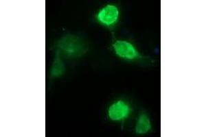 Image no. 3 for anti-CD163 (CD163) antibody (ABIN1497170)
