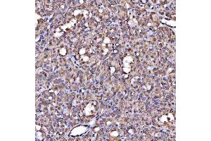 IHC analysis of Scavenging Receptor SRB2/SCARB2 using anti-Scavenging Receptor SRB2/SCARB2 antibody (ABIN7601833). (SCARB2 antibody  (AA 48-357))