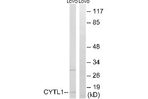 Immunohistochemistry analysis of paraffin-embedded human brain tissue using CYTL1 antibody. (CYTL1 antibody)