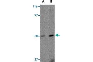 Western blot analysis of FEZ2 in mouse brain tissue lysate with FEZ2 polyclonal antibody  at (A) 0. (FEZ2 antibody  (C-Term))