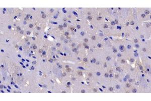Detection of CASP3 in Mouse Cerebrum Tissue using Polyclonal Antibody to Caspase 3 (CASP3) (Caspase 3 antibody  (AA 29-175))