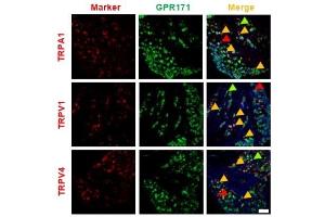 Double immunostaining of GPR171 expressions in Transient receptor potential (TRP)-expresser neurons and the effect on TRP-mediated nociceptions of GPR171 activation. (TRPA1 antibody  (AA 1050-1120))