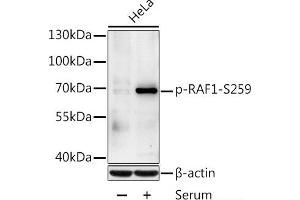 Western blot analysis of extracts of HeLa cells using Phospho-RAF1(S259) Polyclonal Antibody at dilution of 1:1000. (RAF1 antibody  (pSer259))