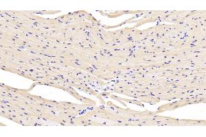 Immunohistochemistry (IHC) image for anti-Lactate Dehydrogenase B (LDHB) (AA 1-334) antibody (ABIN7433969)
