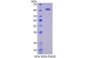 SDS-PAGE (SDS) image for Pim-1 Oncogene (PIM1) (AA 129-268) protein (His tag,GST tag) (ABIN1171112)