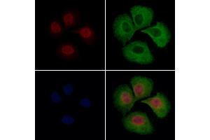 hFANCI Antibody staining Hela cells by IF/ICC.