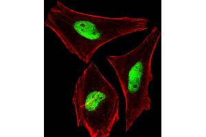 Immunofluorescent analysis of 4 % paraformaldehyde-fixed, 0. (PHF6 antibody  (AA 315-349))