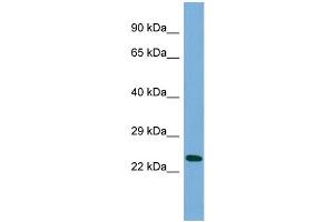 Host:  Rabbit  Target Name:  MANEAL  Sample Type:  HepG2 Whole cell lysates  Antibody Dilution:  1. (MANEAL antibody  (Middle Region))