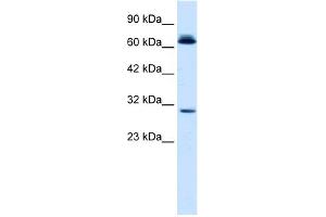 WB Suggested Anti-SIRT3 Antibody Titration:  0. (SIRT3 antibody  (C-Term))