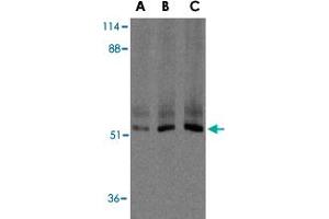 Western blot analysis of XIAP in human kidney lysate with XIAP polyclonal antibody  at 0. (XIAP antibody  (C-Term))