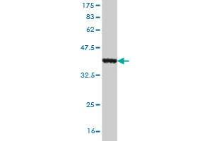 Western Blotting (WB) image for anti-Olfactomedin 3 (OLFM3) (AA 108-206) antibody (ABIN530440)