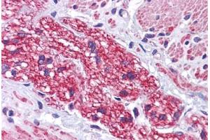 Human Colon, Nerve: Formalin-Fixed, Paraffin-Embedded (FFPE) (SIP1 antibody  (C-Term))