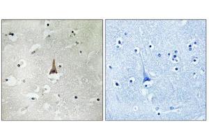 Immunohistochemistry analysis of paraffin-embedded human brain tissue using LRP10 antibody. (LRP10 antibody  (Internal Region))