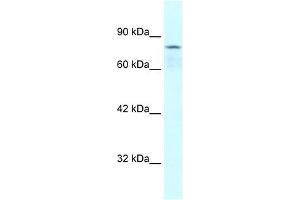 Human Jurkat; WB Suggested Anti-COLEC12 Antibody Titration: 0. (COLEC12 antibody  (Middle Region))