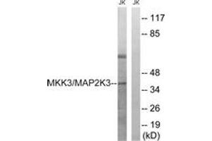 Western blot analysis of extracts from Jurkat cells, treated with serum 20% 15', using MAP2K3 (Ab-222) Antibody.