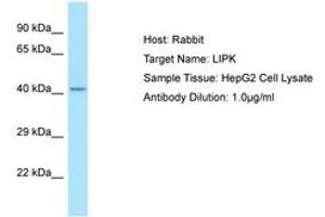 Image no. 1 for anti-Lipase, Family Member K (LIPK) (N-Term) antibody (ABIN6750053) (LIPK antibody  (N-Term))