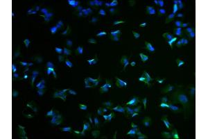 Immunofluorescence staining of MCF-7 cells with ABIN7167574 at 1:100, counter-stained with DAPI. (RIMS4 antibody  (AA 1-269))