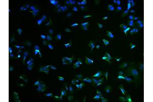 Immunofluorescence staining of MCF-7 cells with ABIN7167574 at 1:100, counter-stained with DAPI. (RIMS4 antibody  (AA 1-269))