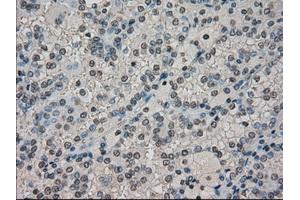 Image no. 1 for anti-Dihydrofolate Reductase (DHFR) antibody (ABIN1497822) (Dihydrofolate Reductase antibody)