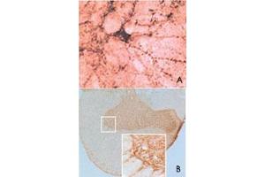 Immunohistochemical staining of SNCB in rat spinal cord using SNCB polyclonal antibody  at a dilution of 1 : 1000.