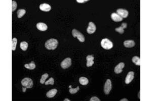 Immunofluorescent staining of U-2 OS (ATCC HTB-96) cells. (PARP1 antibody)