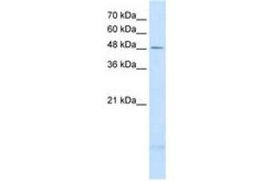 Image no. 2 for anti-Pleckstrin and Sec7 Domain Containing 3 (PSD3) (AA 67-116) antibody (ABIN204997) (PSD3 antibody  (AA 67-116))