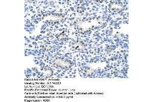 Rabbit Anti-PAIP1 Antibody  Paraffin Embedded Tissue: Human Lung Cellular Data: Alveolar cells Antibody Concentration: 4. (PAIP1 antibody  (C-Term))