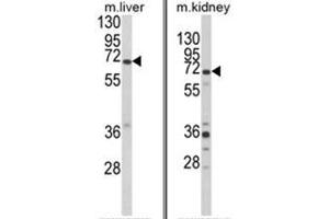(LEFT) Western blot analysis of EHHADH Antibody (C-term) in mouse liver tissue lysates (35ug/lane).