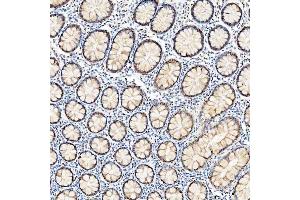 IHC analysis of U1-C/SNRPC using anti-U1-C/SNRPC antibody (ABIN7599016). (SNRPC antibody  (AA 1-159))