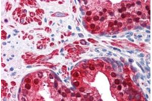 Human Prostate: Formalin-Fixed, Paraffin-Embedded (FFPE) (IDH1 antibody  (AA 30-307))