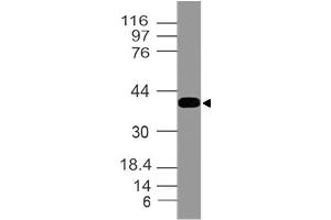 Image no. 1 for anti-SWI/SNF Related, Matrix Associated, Actin Dependent Regulator of Chromatin, Subfamily B, Member 1 (SMARCB1) (AA 11-231) antibody (ABIN5027322) (SMARCB1 antibody  (AA 11-231))