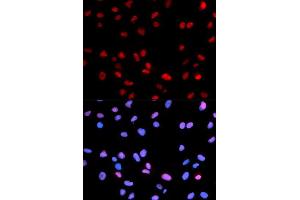 Immunofluorescence analysis of U2OS cell using Phospho-RB-S795 antibody.