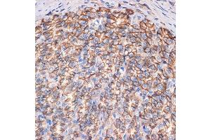 Immunohistochemistry of paraffin-embedded rat stomach using CTNN Rabbit mAb (ABIN7266135) at dilution of 1:100 (40x lens). (CTNNA3 antibody)