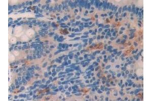 Detection of LCNL1 in Rat Small intestine Tissue using Polyclonal Antibody to Lipocalin Like Protein 1 (LCNL1) (LCNL1 antibody)