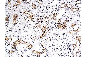 Formalin-fixed and paraffin embedded rat renal tubular endothelial cells labeled with Anti-EAAT3, Unconjugated (ABIN733943) followed by conjugation to the secondary antibody and DAB staining (SLC1A1 antibody  (AA 451-524))