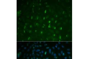 Immunofluorescence analysis of U2OS cells using Phospho-γH2A. (gamma H2AX antibody  (pSer139))