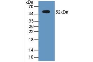 Detection of Recombinant MUC1, Mouse using Polyclonal Antibody to Mucin 1 (MUC1) (MUC1 antibody  (AA 474-630))