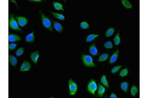 Immunofluorescent analysis of A549 cells using ABIN7175150 at dilution of 1:100 and Alexa Fluor 488-congugated AffiniPure Goat Anti-Rabbit IgG(H+L) (USHBP1 antibody  (AA 1-260))