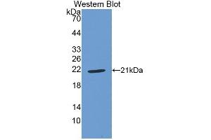 Detection of Recombinant GPX1, Human using Polyclonal Antibody to Glutathione Peroxidase 1 (GPX1) (Glutathione Peroxidase 1 antibody  (AA 50-203))