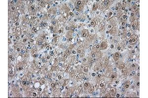 Immunohistochemical staining of paraffin-embedded prostate tissue using anti-PDE4A mouse monoclonal antibody. (PDE4A antibody)